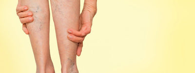 Kojų sunkumas, skausmas ar tinimas? Klastingas negalavimas, kurio nevalia ignoruoti