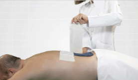 ARTCURE difuziniai pleistrai  ir gelis